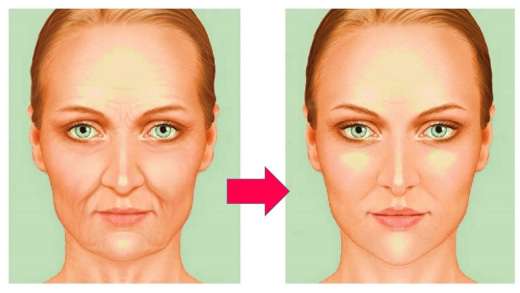 Yağ Dolgusu – Lipofilling