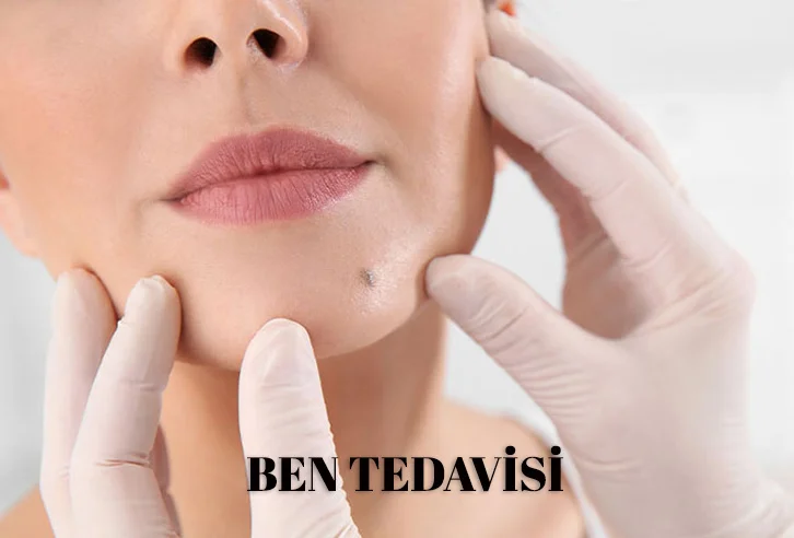 Ben Tedavisi Konya