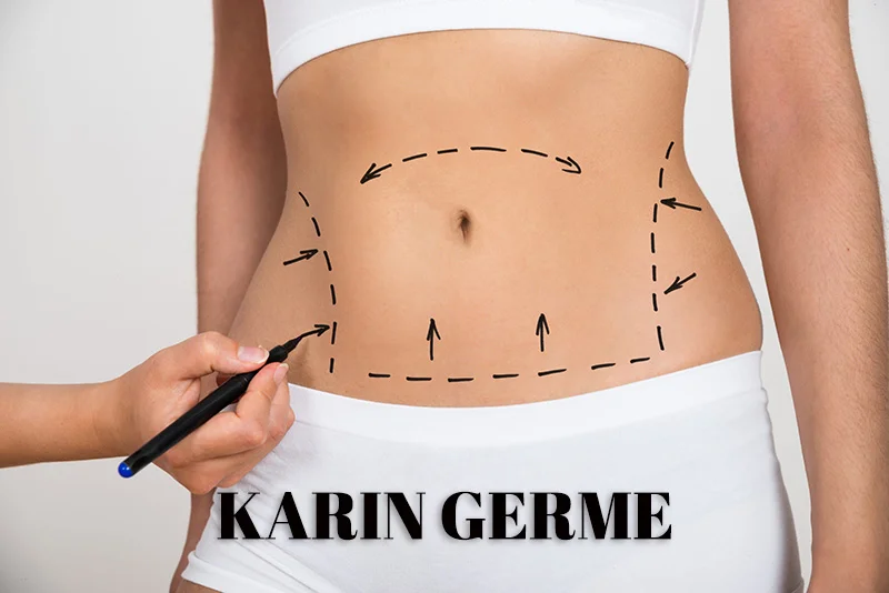 Karın Germe Ameliyatı Konya