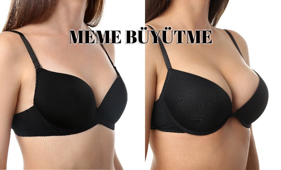 Meme Büyütme Konya