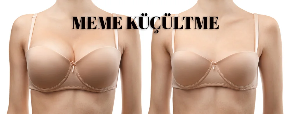 Meme Küçültme Konya