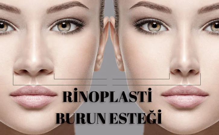 Burun Estetiği