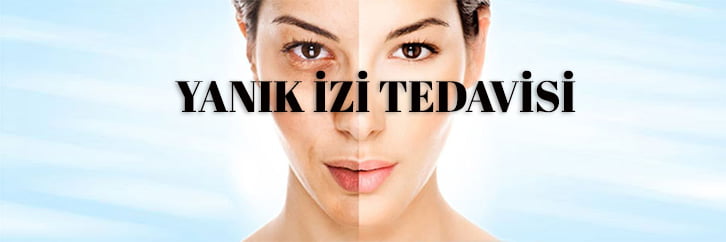 Yanık izi tedavisi konya