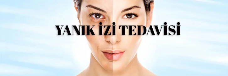 Yanık izi tedavisi konya